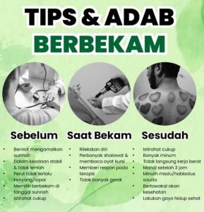 Tips & Adab Berbekam; Sebelum, saat dan sesudah berbekam