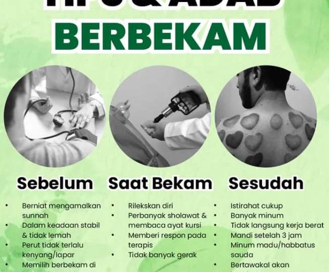 Tips & Adab Berbekam; Sebelum, saat dan sesudah berbekam